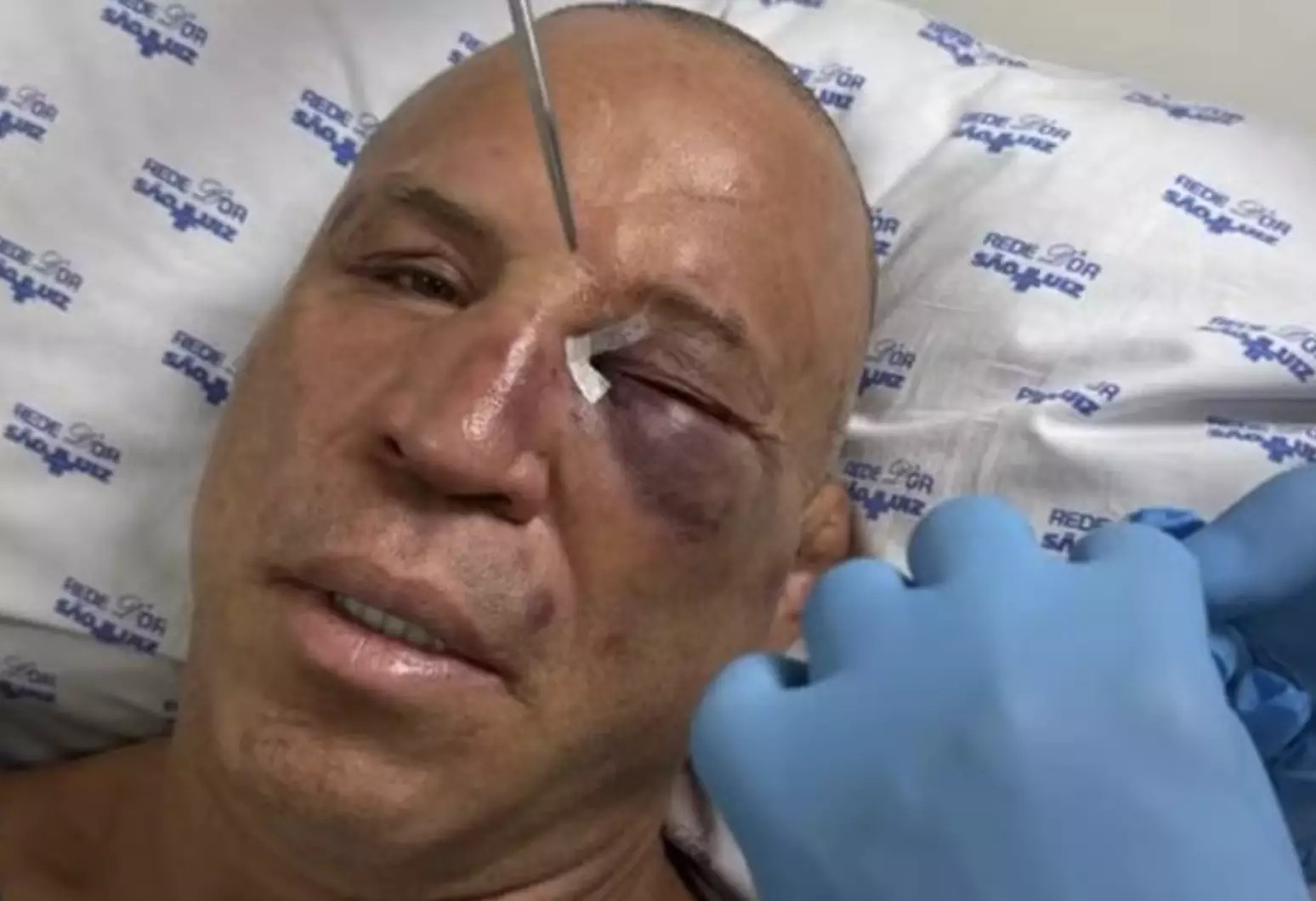 Wanderlei Silva quebra o nariz e leva pontos após confusão em luta contra Popó