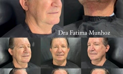 Homens também procuram? A nova demanda masculina na estética cresce em Cuiabá e Sinop