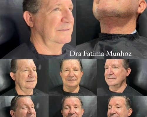 Homens também procuram? A nova demanda masculina na estética cresce em Cuiabá e Sinop
