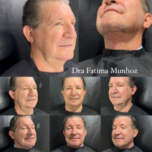 Homens também procuram? A nova demanda masculina na estética cresce em Cuiabá e Sinop