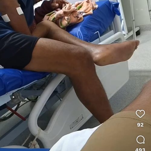 Família denuncia descaso na saúde pública de Cuiabá: paciente com pé necrosado aguarda cirurgia há mais de um mês no HMC