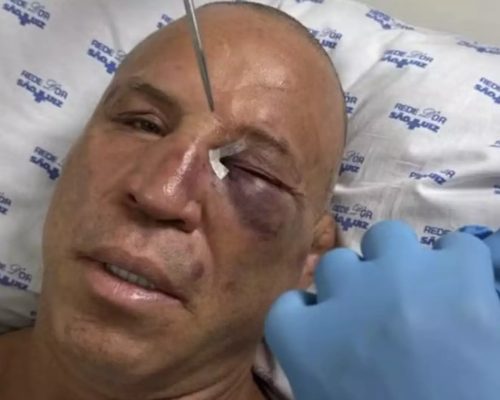Wanderlei Silva quebra o nariz e leva pontos após confusão em luta contra Popó