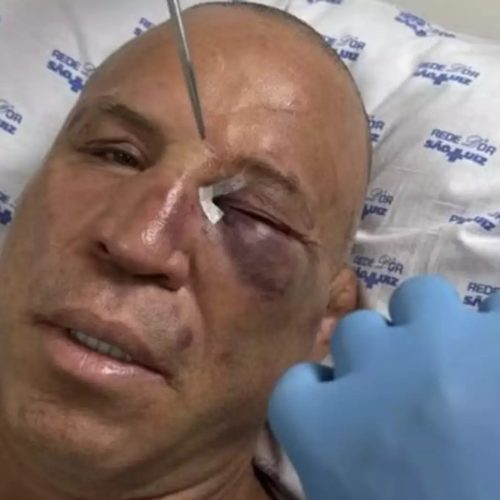 Wanderlei Silva quebra o nariz e leva pontos após confusão em luta contra Popó