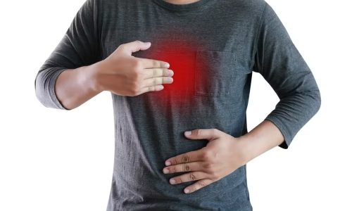 Por que o omeprazol está sendo cortado das receitas médicas — e quando ele pode ser usado com segurança