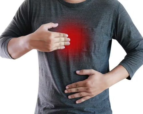 Por que o omeprazol está sendo cortado das receitas médicas — e quando ele pode ser usado com segurança