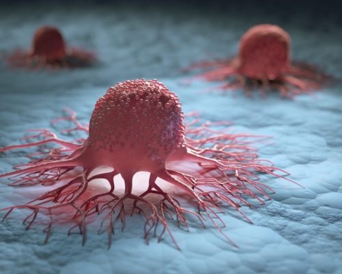 Casos de câncer em jovens de até 50 anos crescem quase 300% no Brasil em 11 anos, alerta levantamento