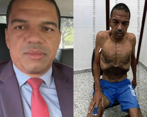 “Não sente mais as pernas”: saúde de suspeito de vender sentenças se agrava, e família alerta para risco de morte